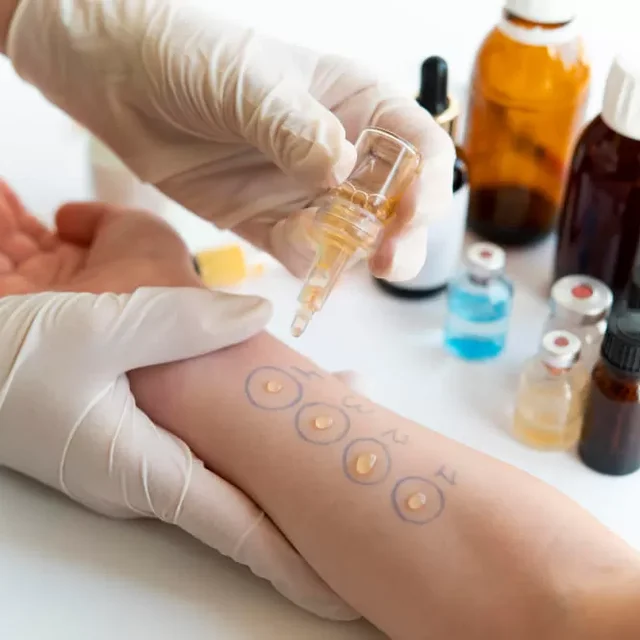 Medicina Imunoalergologia